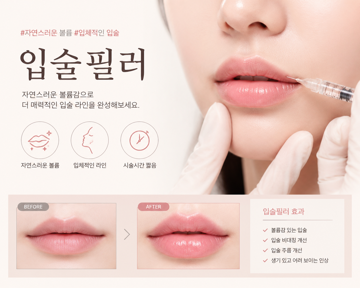 입술필러